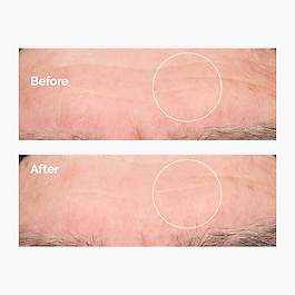 Hyaluronic Acid 2% + B5 - Feuchtigkeitsserum